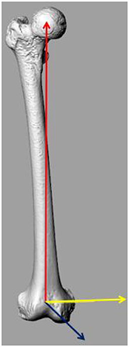 Navigation image of the femoral component planning. The size of the