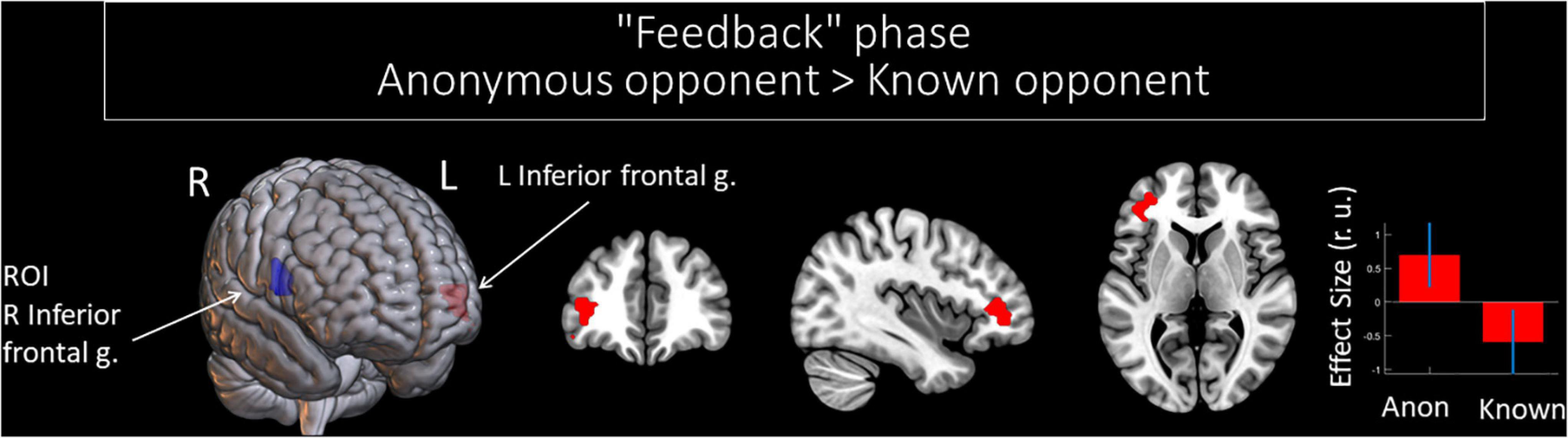 Frontiers  Spontaneous Brain Activity Did Not Show the Effect of Violent Video  Games on Aggression: A Resting-State fMRI Study