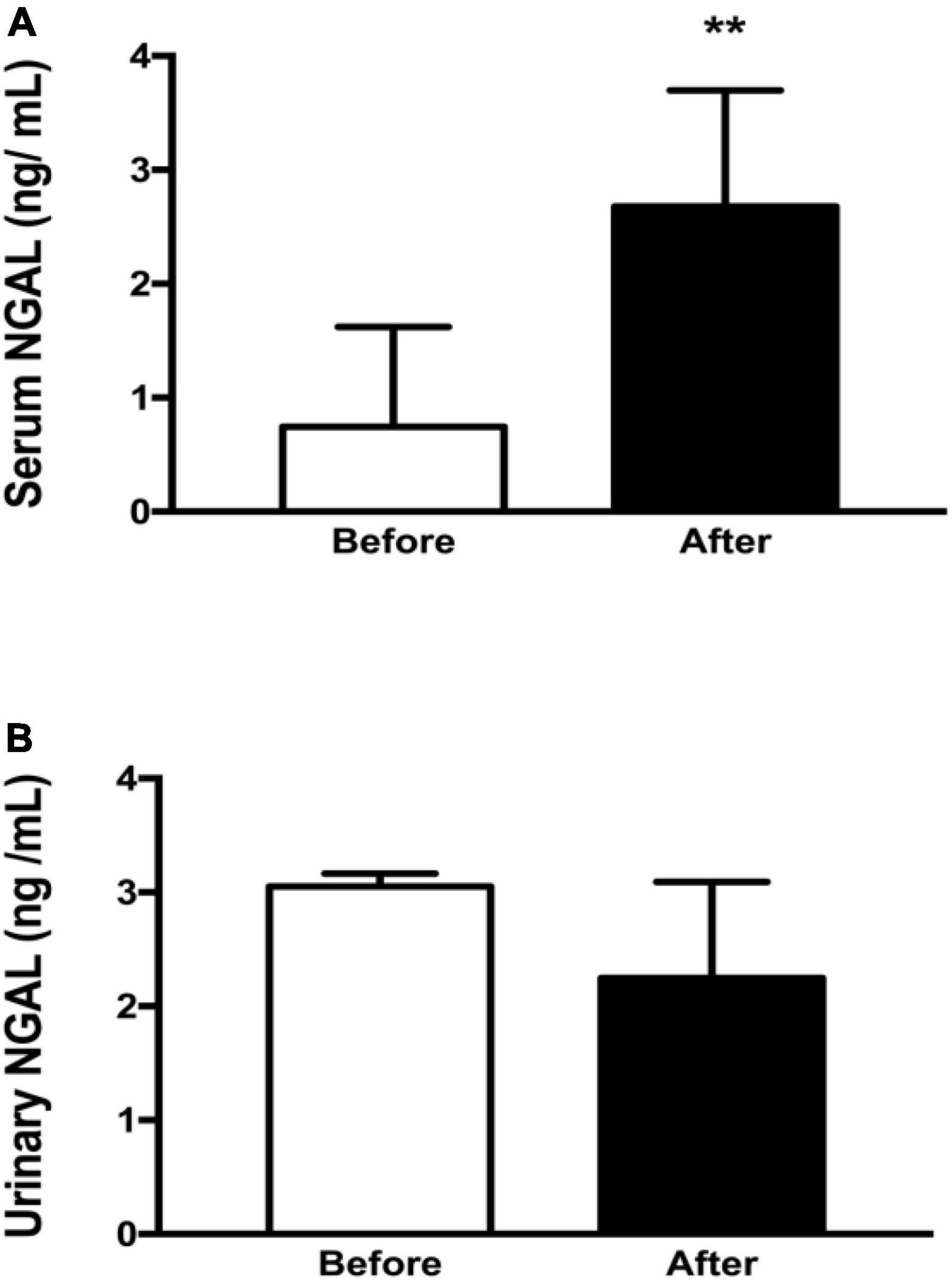 Urinary neutrophil gelatinase-associated lipocalin levels reflect