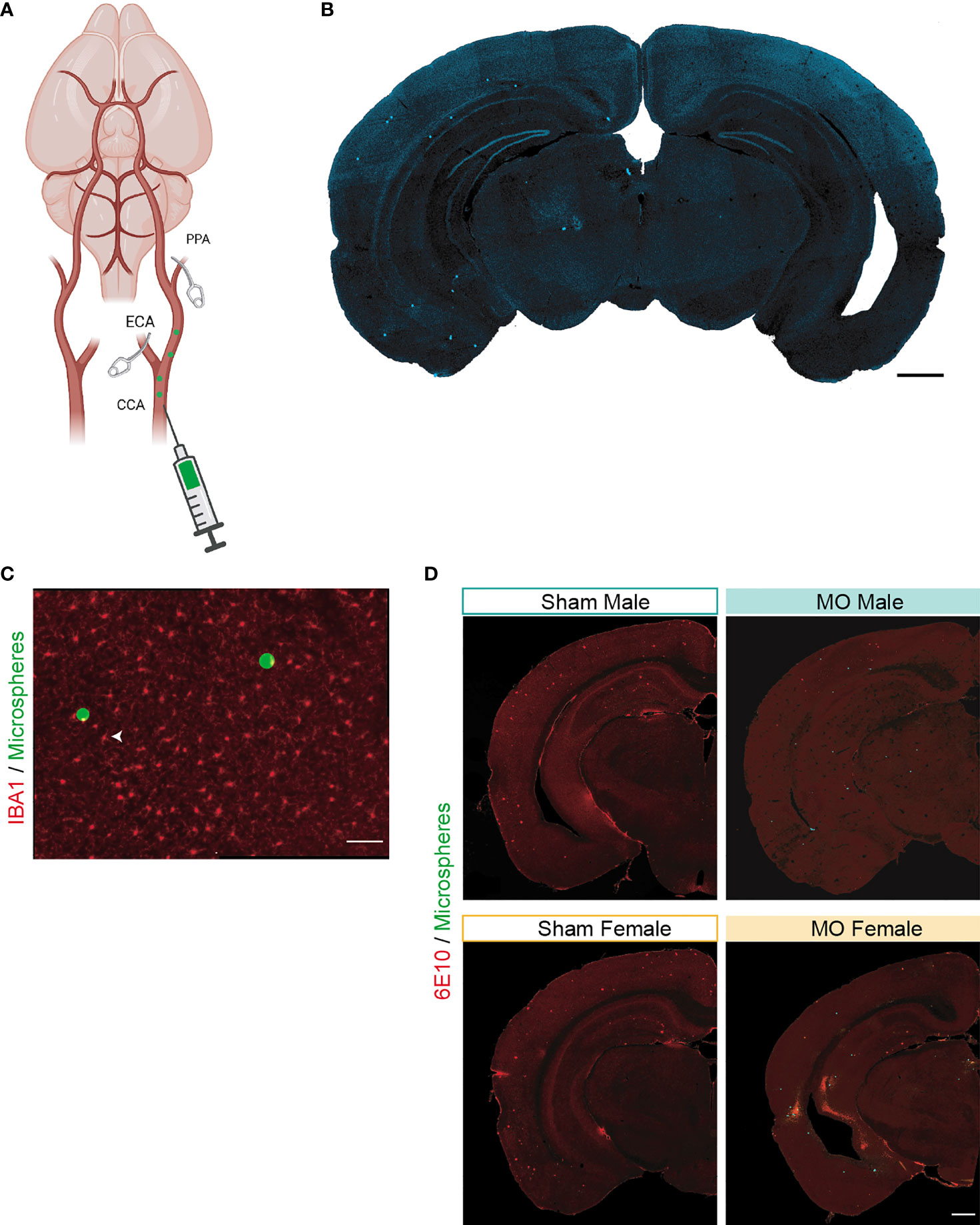 Sarah Walker Sex Videos Download Free - Frontiers | Multifocal Cerebral Microinfarcts Modulate Early Alzheimer's  Disease Pathology in a Sex-Dependent Manner