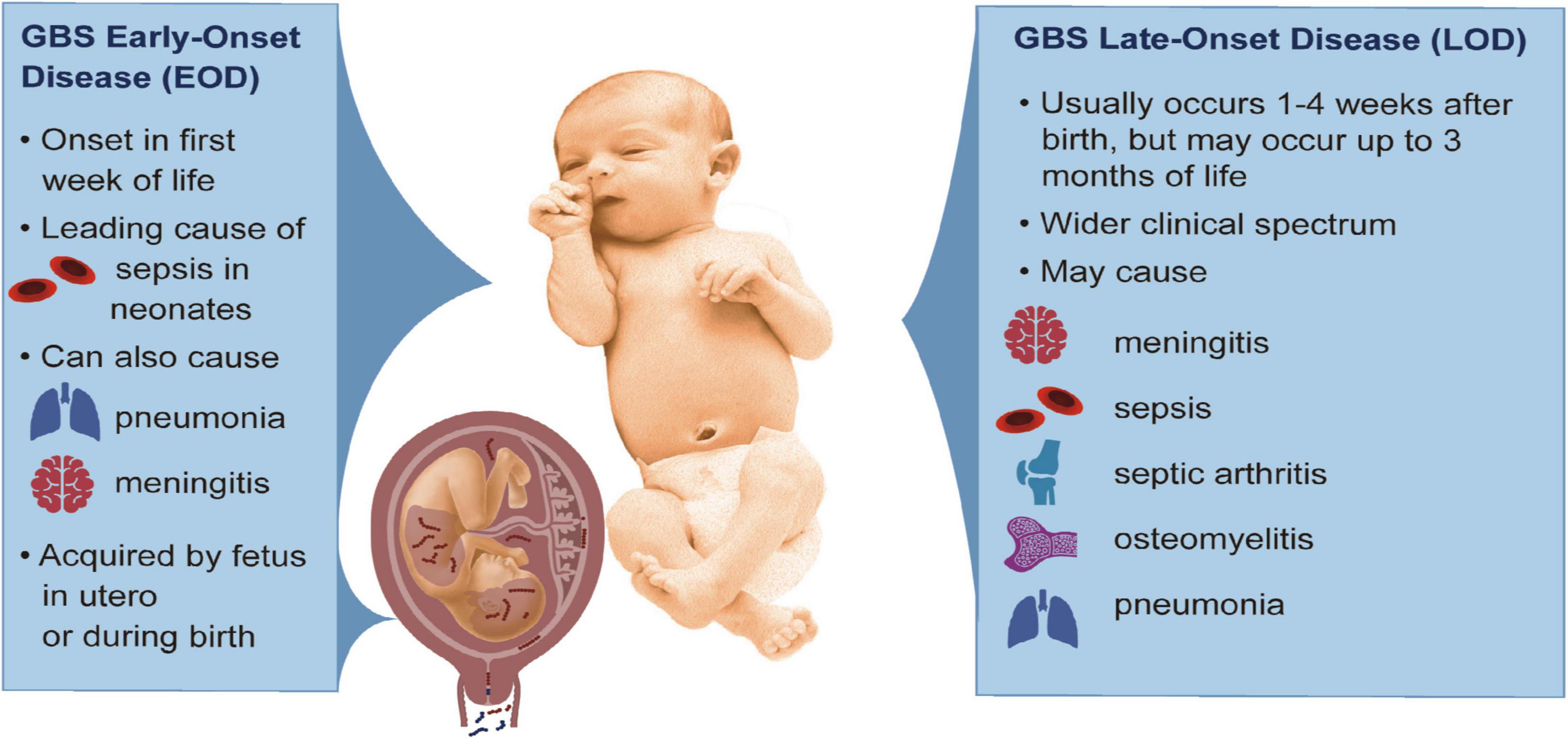 Frontiers Bacterial And Host Determinants Of Group B Streptococcal 