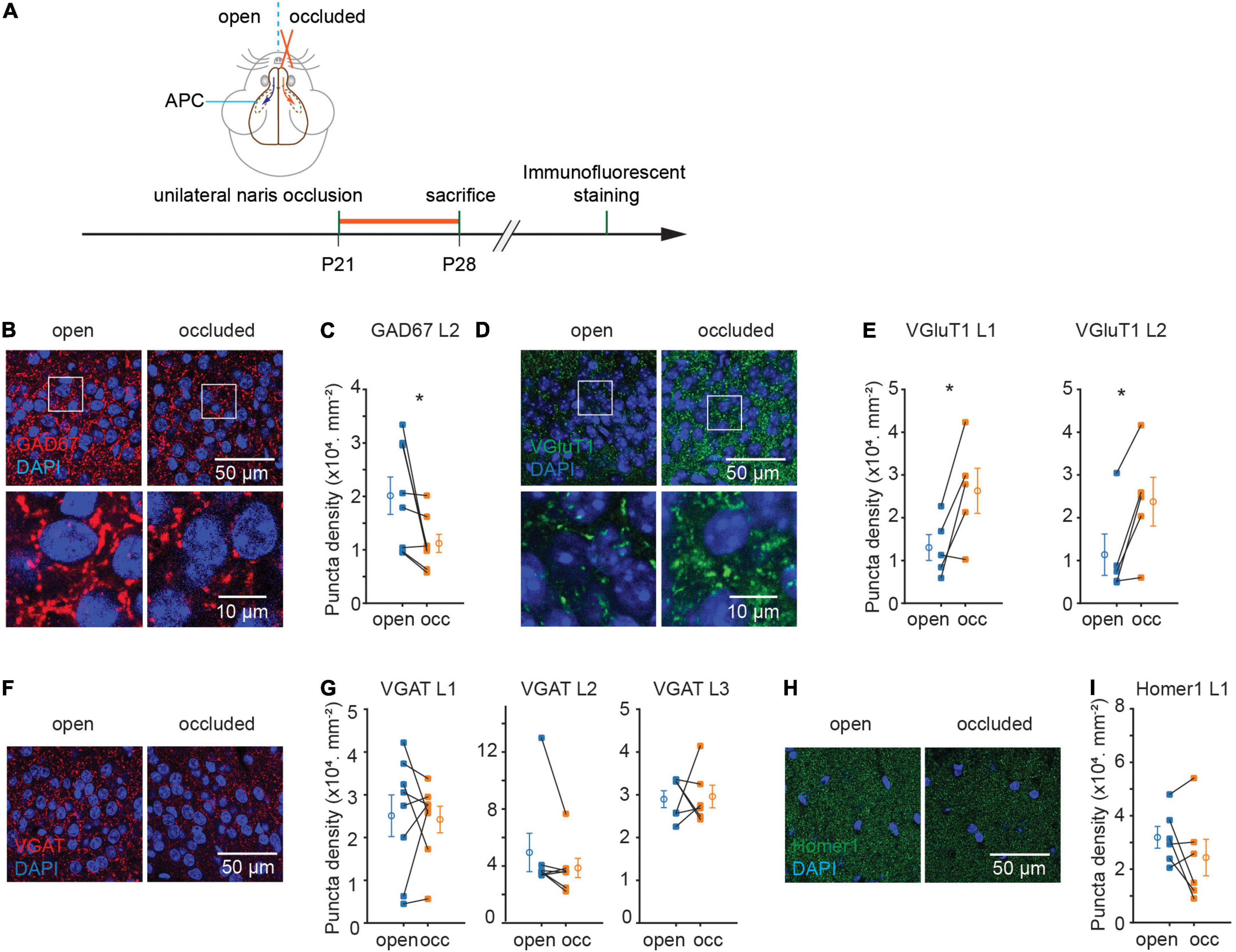 Location and distribution of inhibitory synapses differentially affect