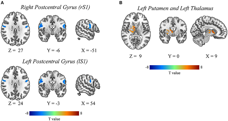 Frontiers  Differential responses from the left postcentral gyrus