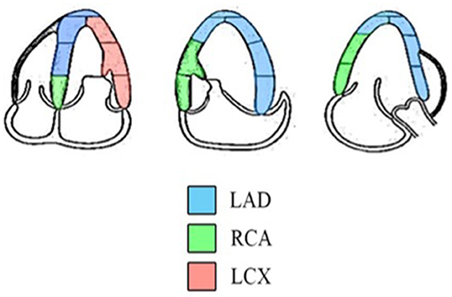 Analysis of myocardial strain of the left ventricle based on 2-D