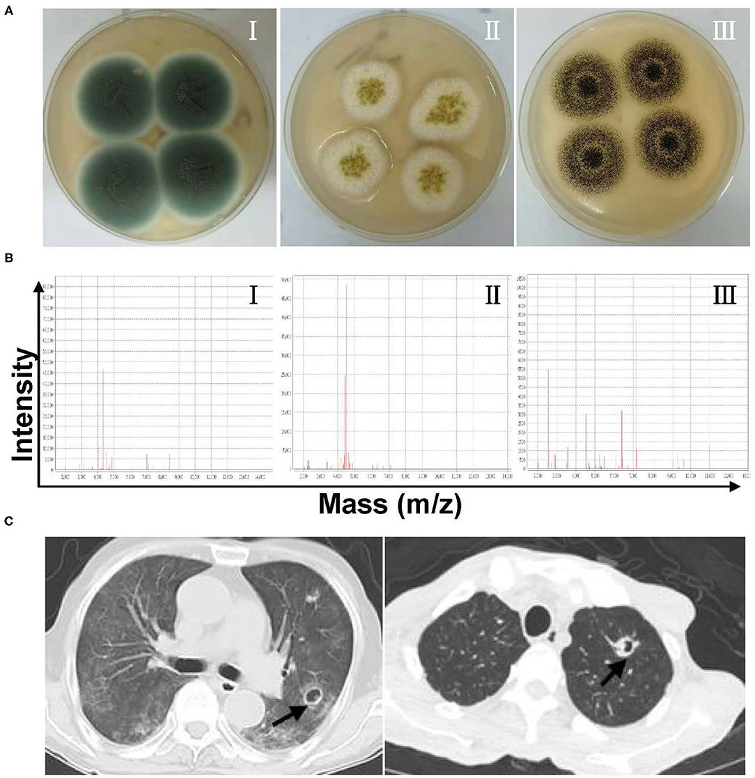 Frontiers | Epidemiology, Drug Susceptibility, And Clinical Risk ...