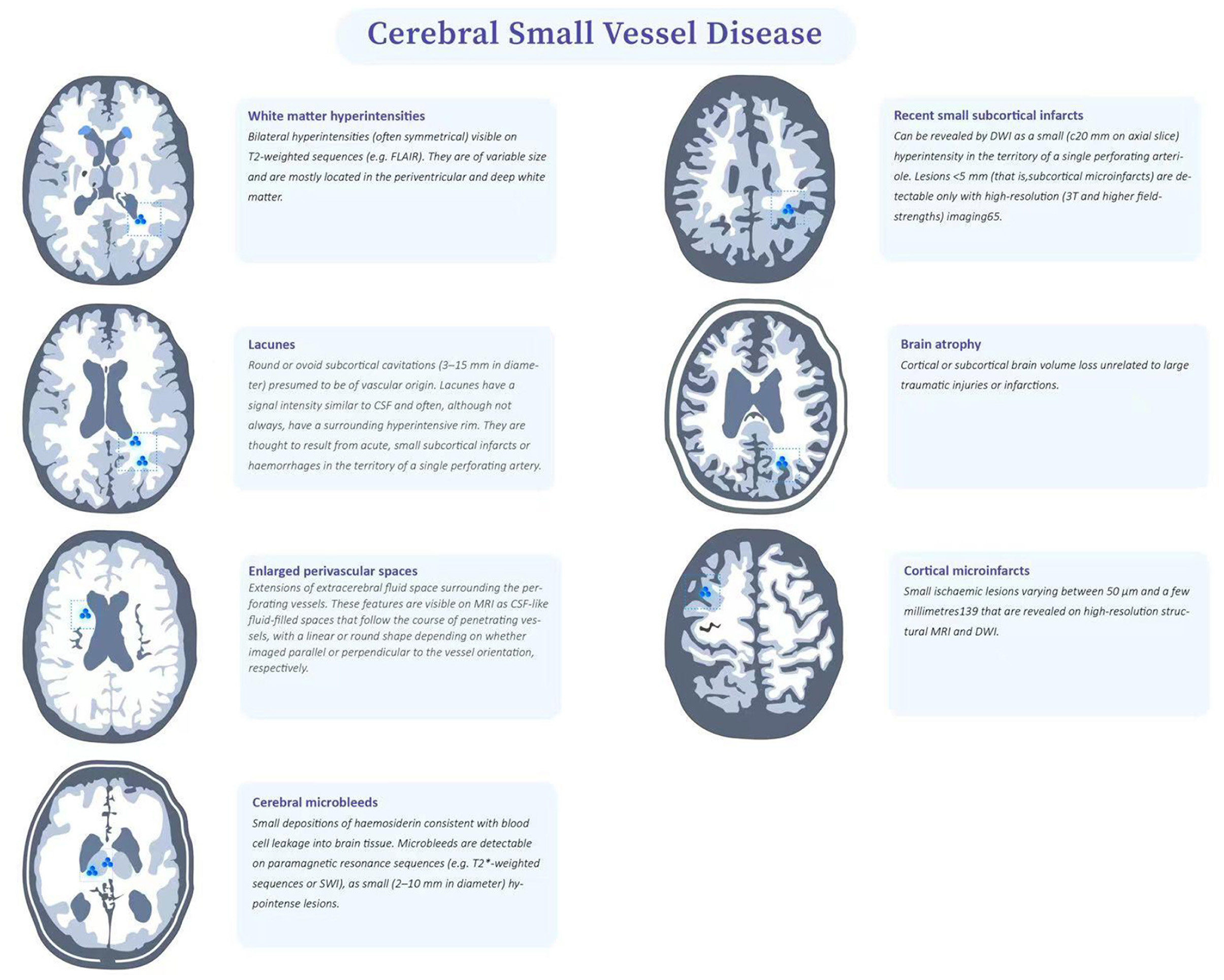 Frontiers Clinical Radiological And Pathological Characteristics 