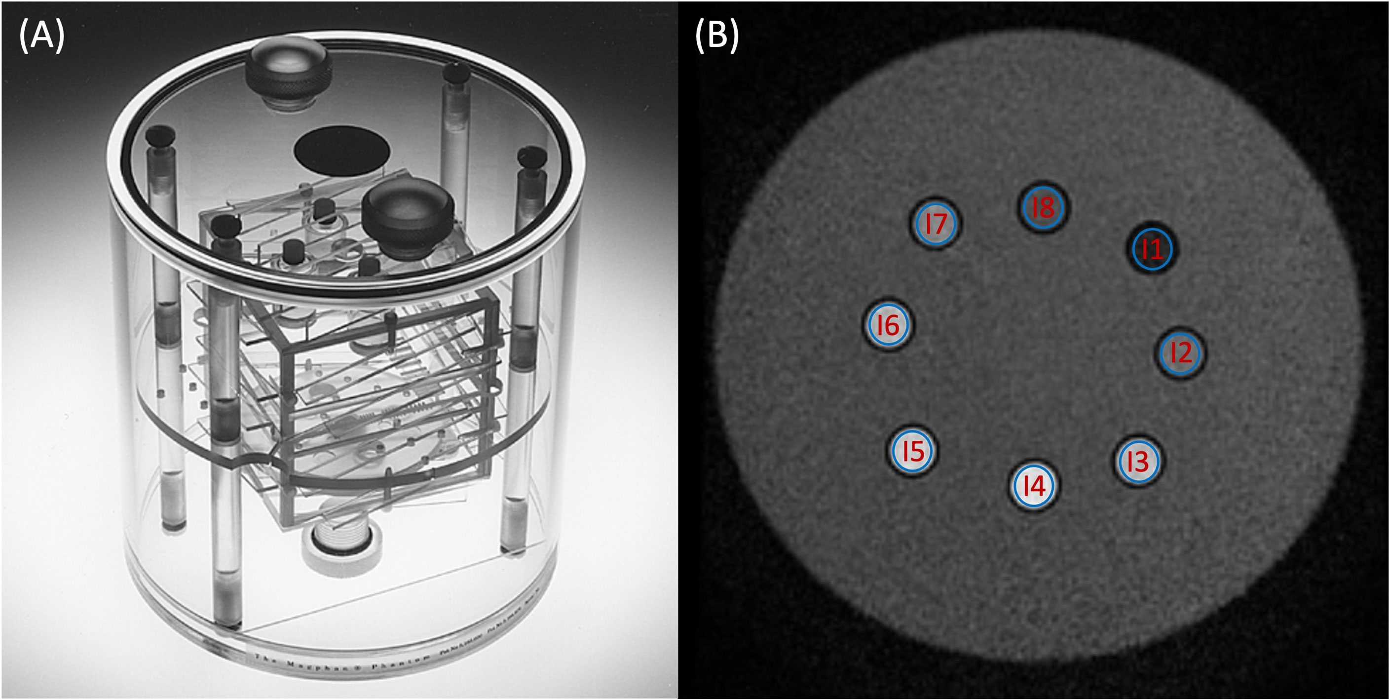 Frontiers  Synthetic MRI for Radiotherapy Planning for Brain and Prostate  Cancers: Phantom Validation and Patient Evaluation