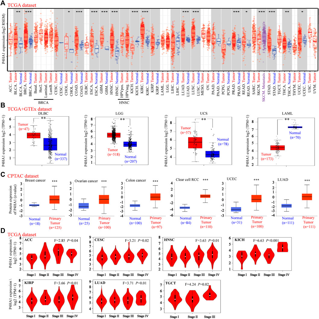 Frontiers | The Role of P4HA1 in Multiple Cancer Types and its 