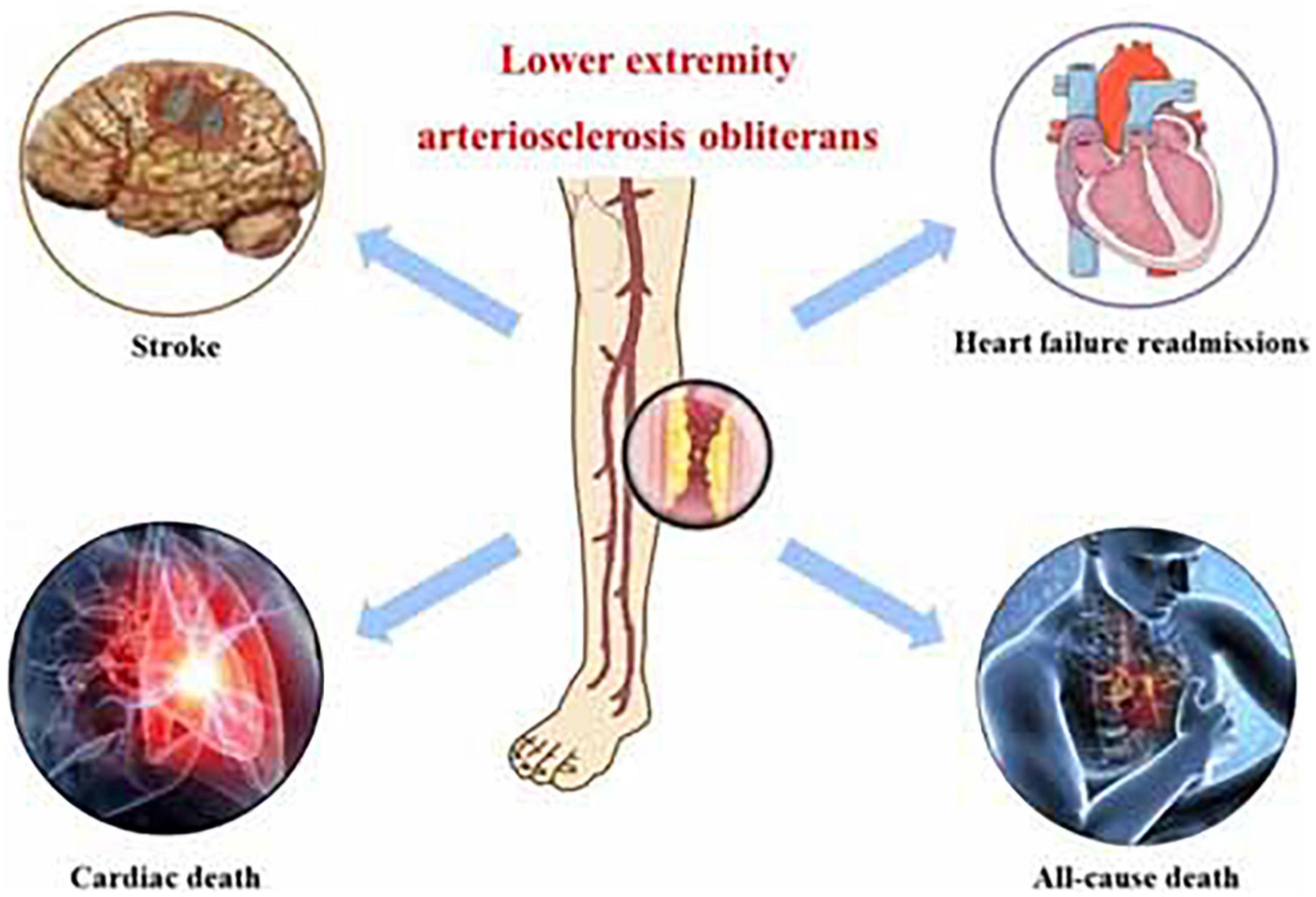 Hypertensive Encephalopathy-Causes-Diagnosis-Related diseases-Best treatment options-Homeopathic treatment-Best Homeopathic doctor Pakistan- Dr Qaisar Ahmed