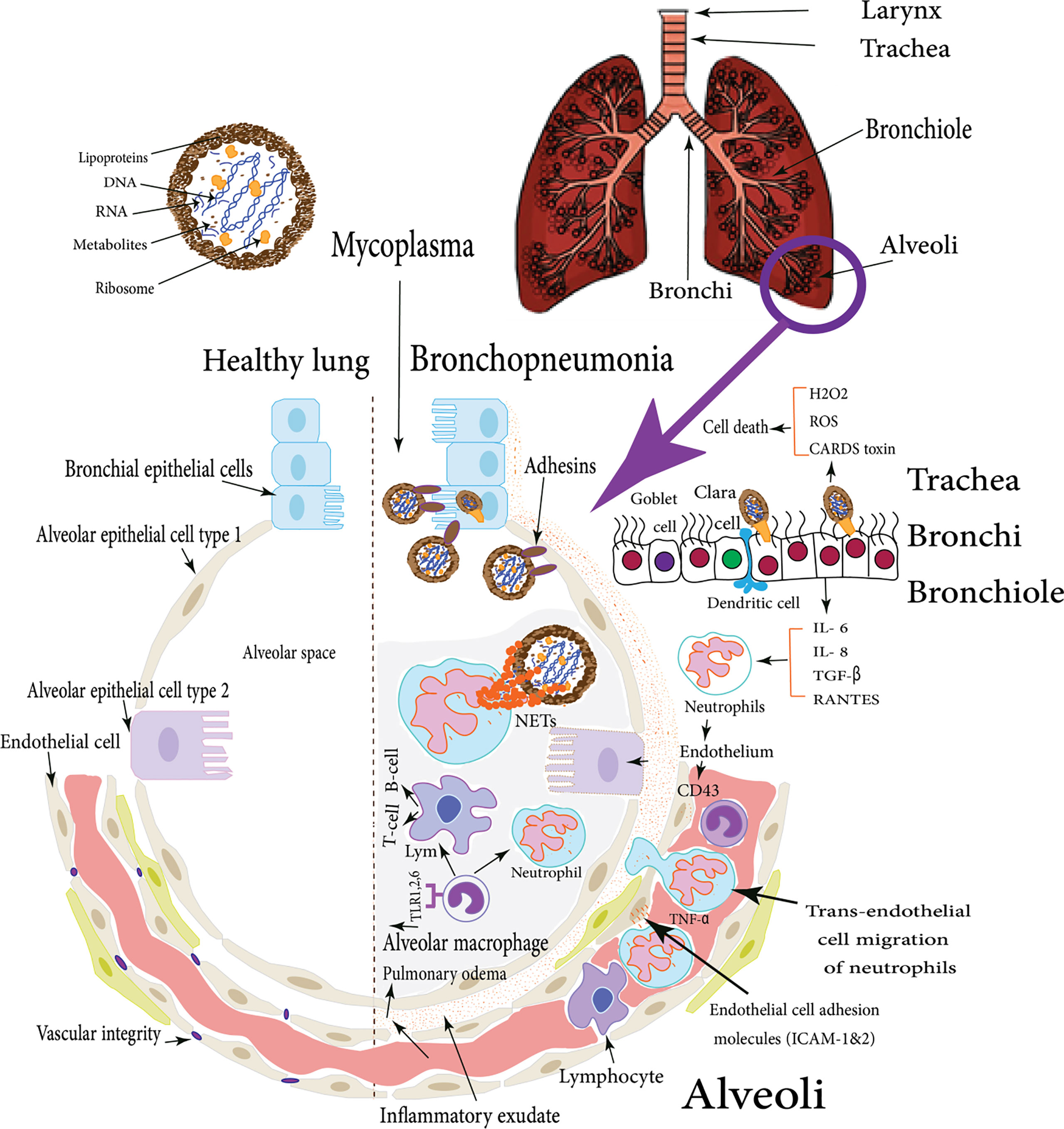 Tuberculosis prevalence: beyond the tip of the iceberg - The Lancet  Respiratory Medicine