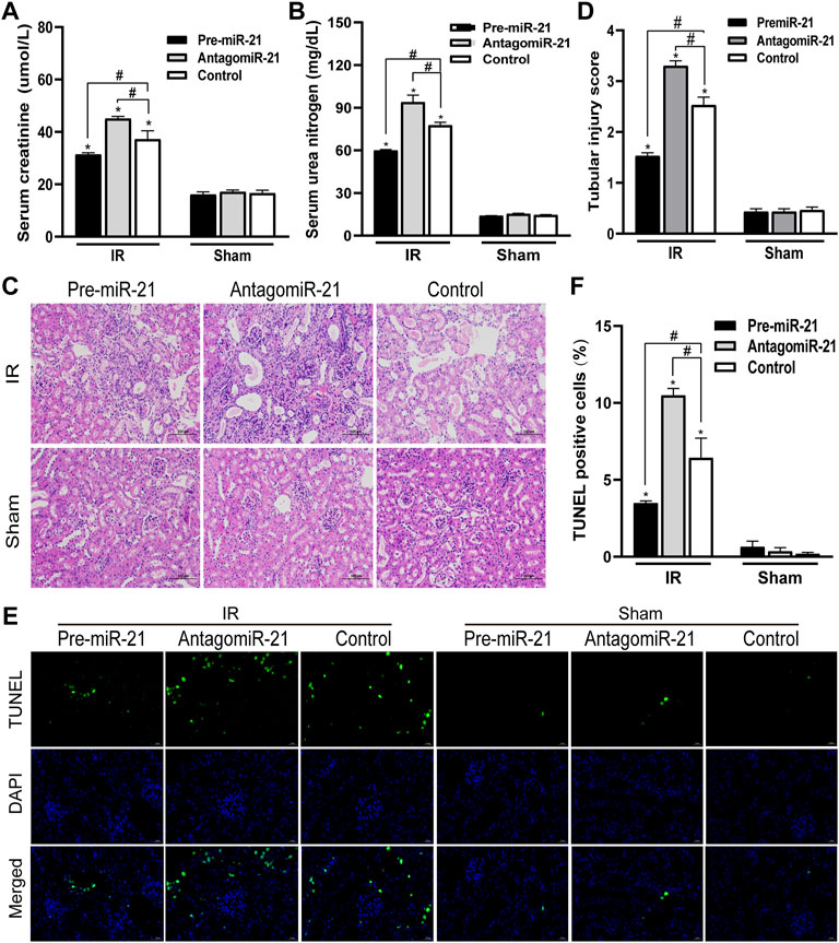 Frontiers | Gender Differential Expression of AR/miR-21 Signaling 