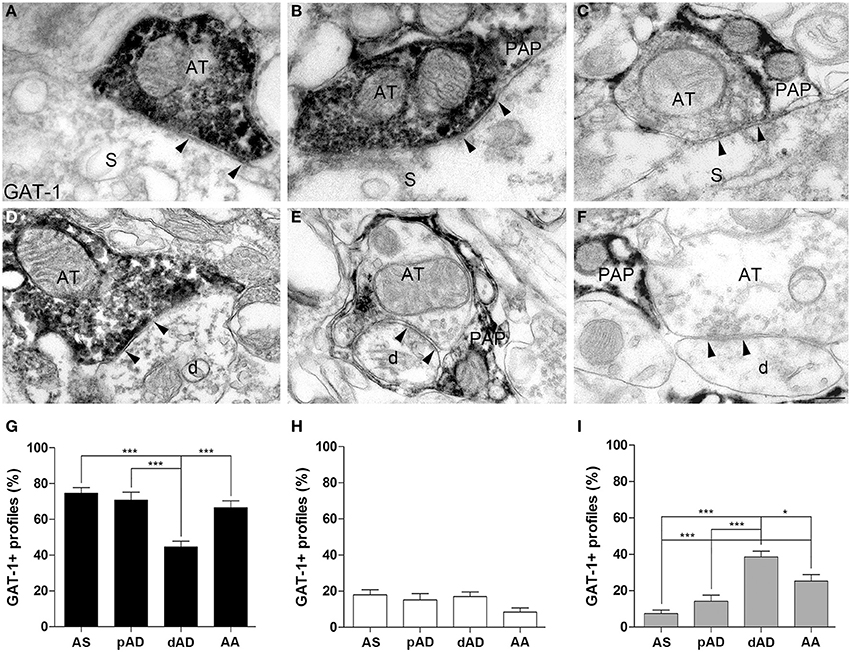 Frontiers | Plasma membrane transporters GAT-1 and GAT-3 contribute to ...