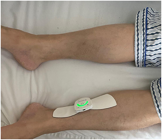 Tibial nerve stimulation using rechargeable TENS Unit : r/OveractiveBladder