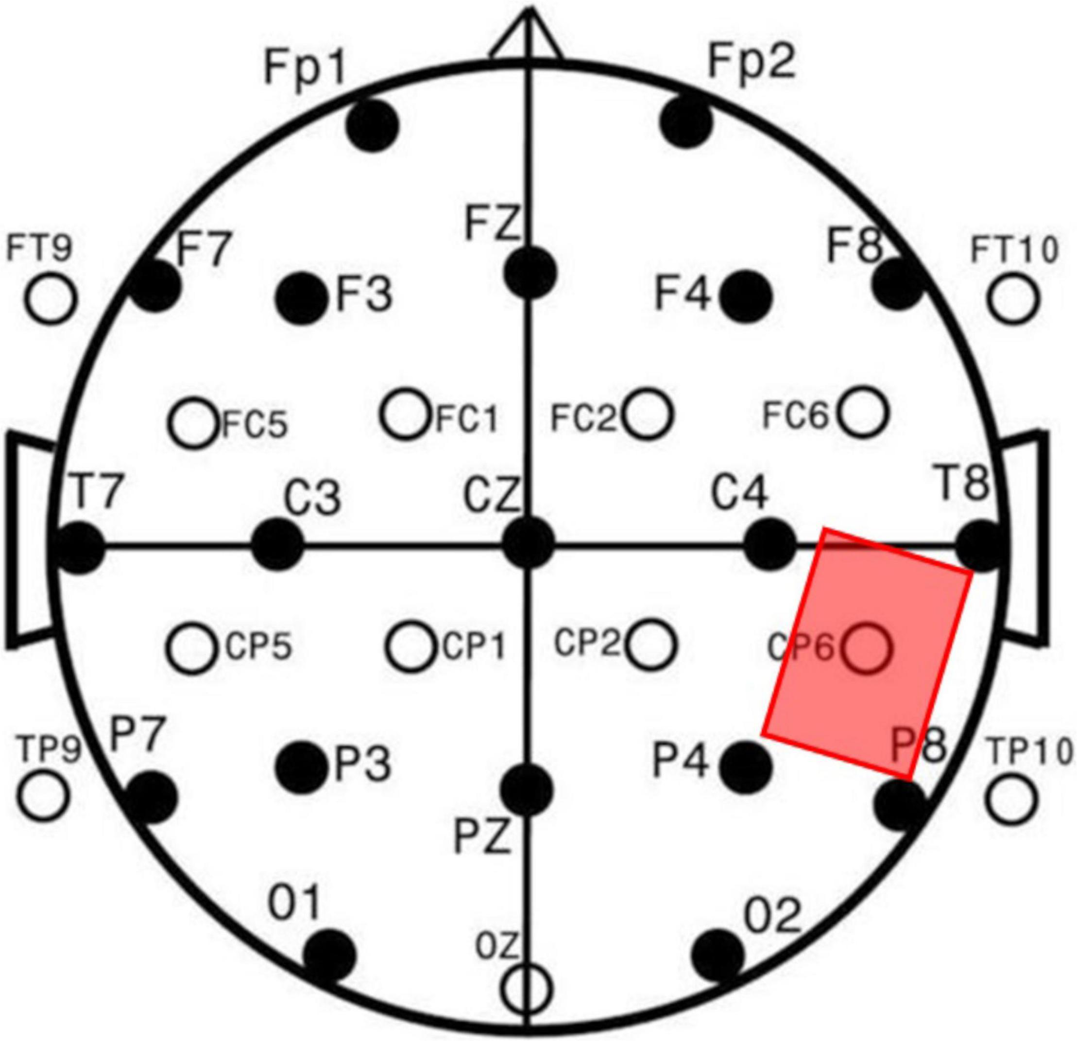 Electrode placement on the face for the both the ES and sham protocol.