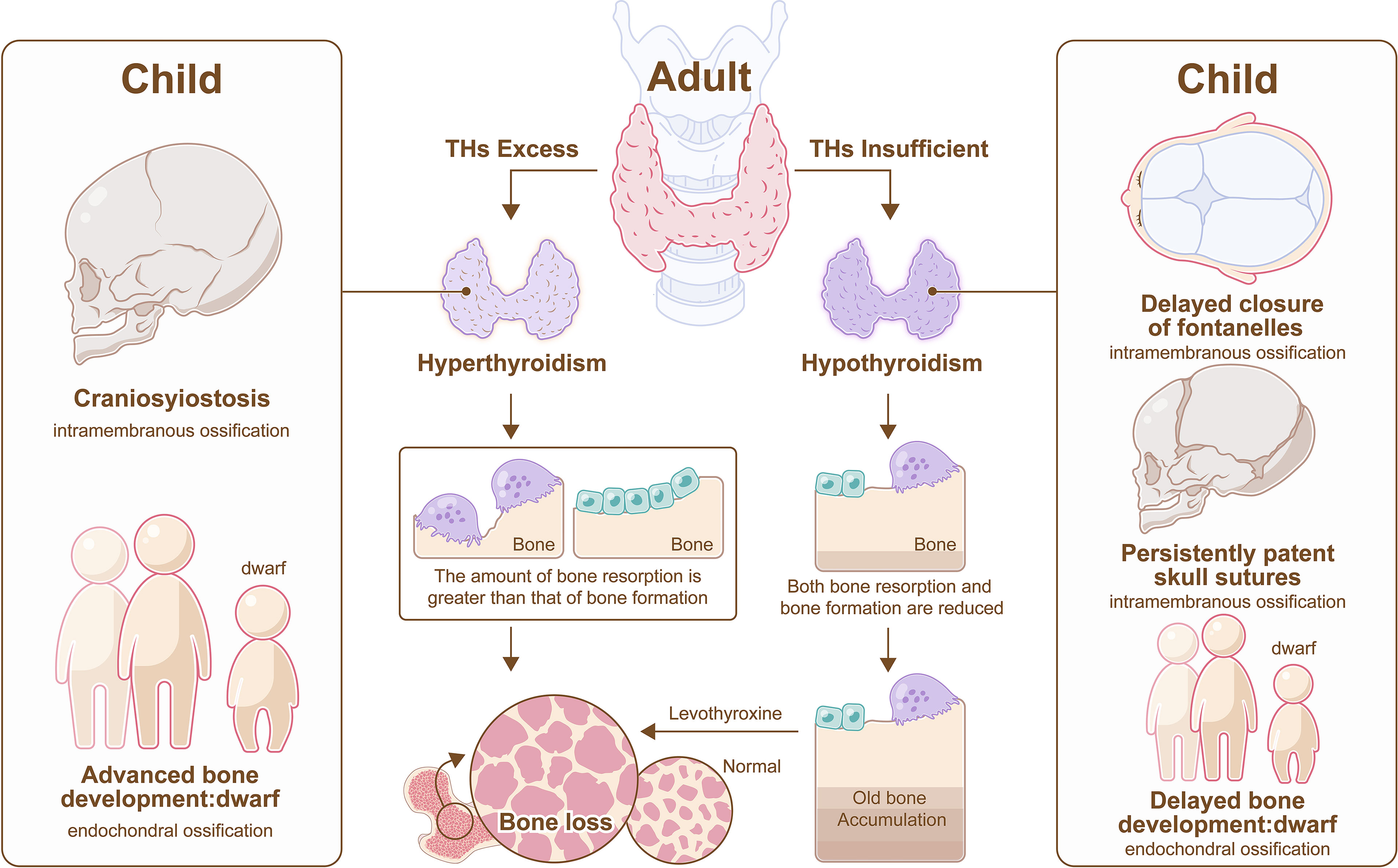 Frontiers | Endocrine Regulation on Bone by Thyroid