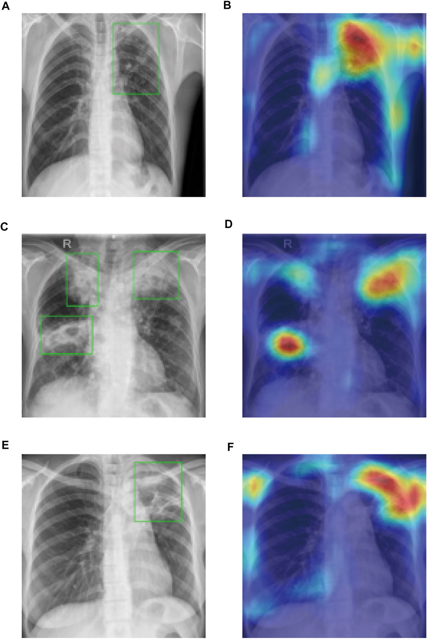 btc radiology