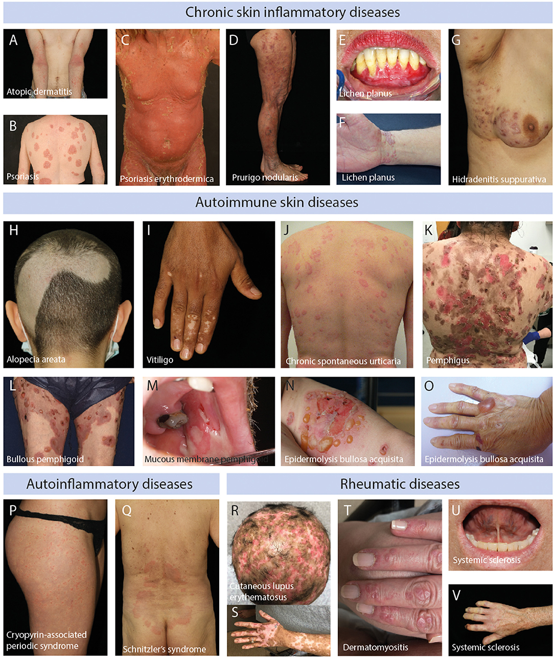 4 Common Skin Diseases and Conditions in Adults