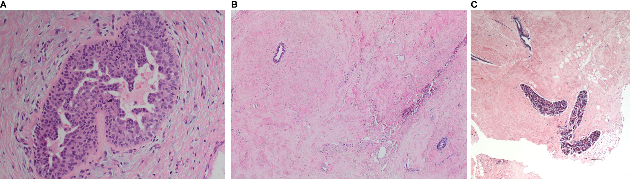 Frontiers  Morphological Features and Immunohistochemical