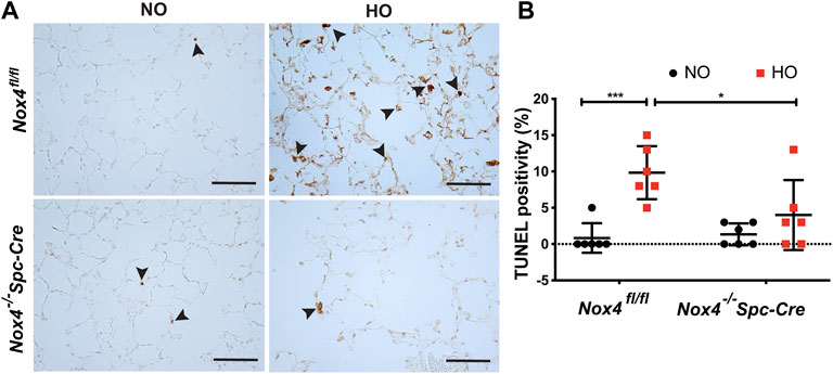 Frontiers | NOX4 Mediates Epithelial Cell Death in Hyperoxic Acute 