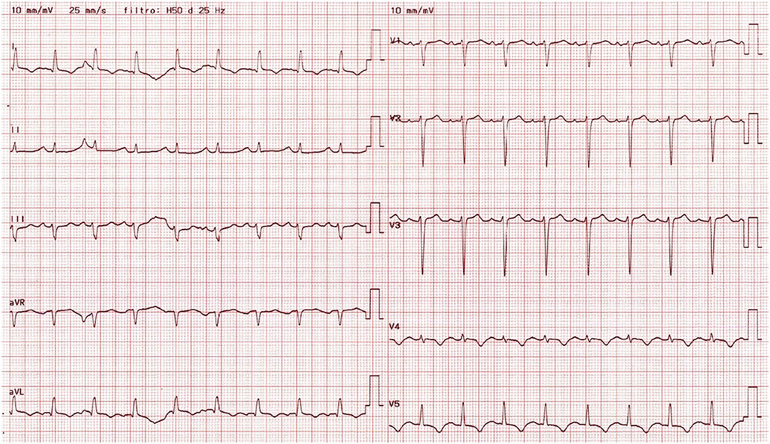 Acute Heart Failure in a 39-Year-Old Man