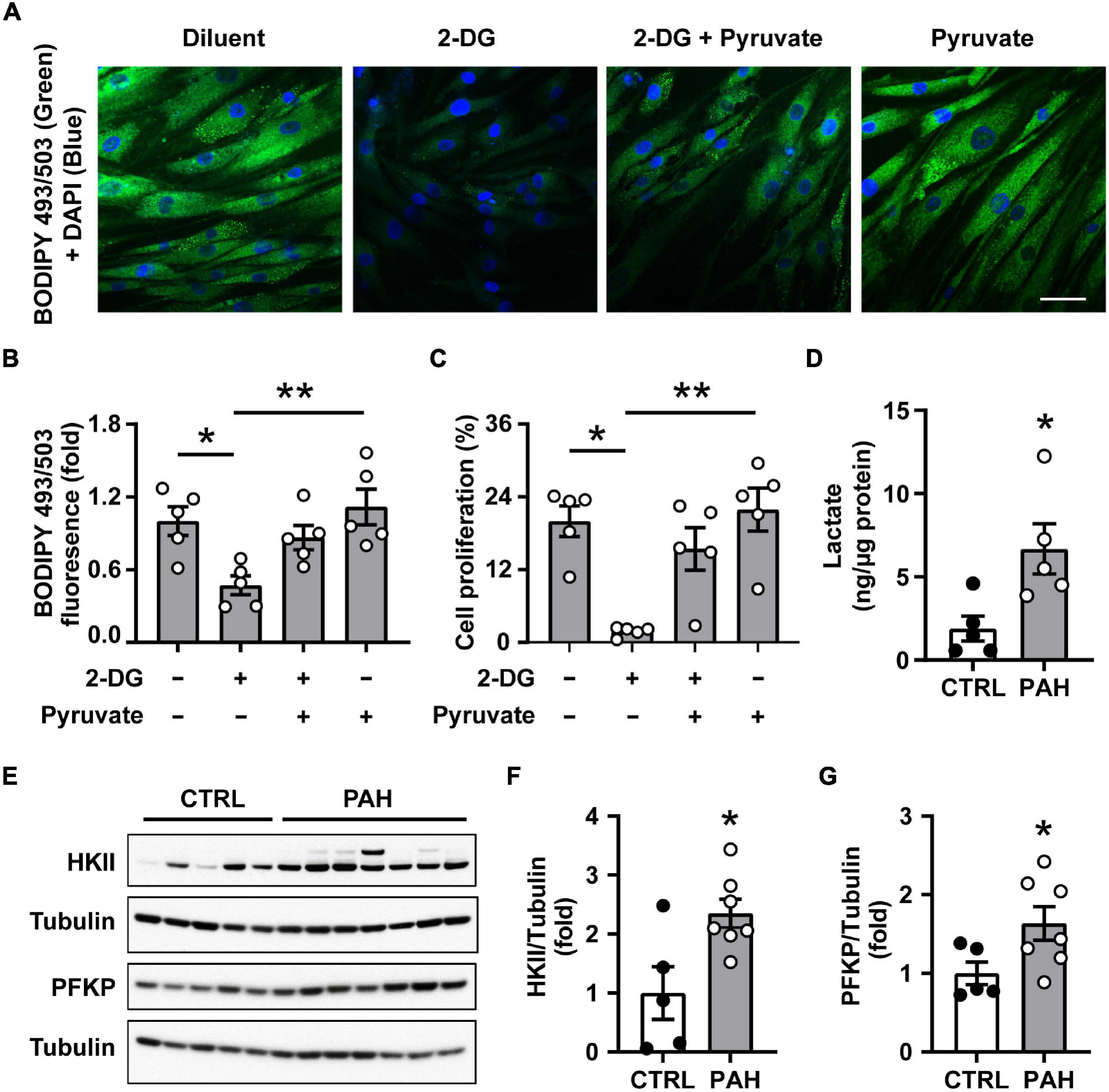 IL-32 in PAH. ( A – D ) Triple-label immunofluorescence images of human