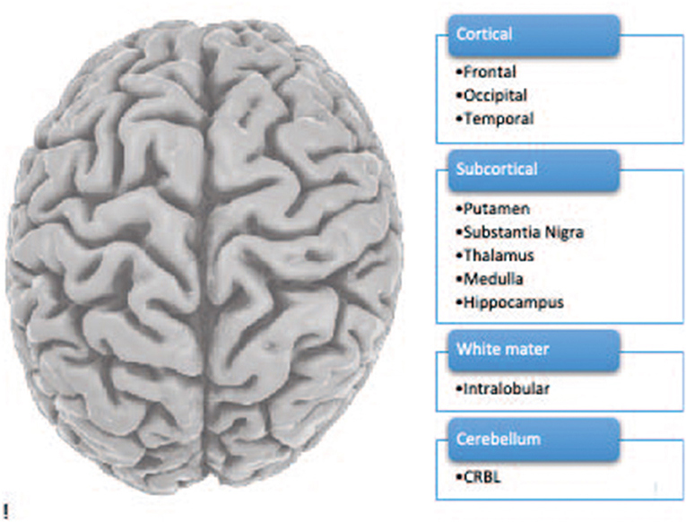 图1 -人脑包括10个脑区。