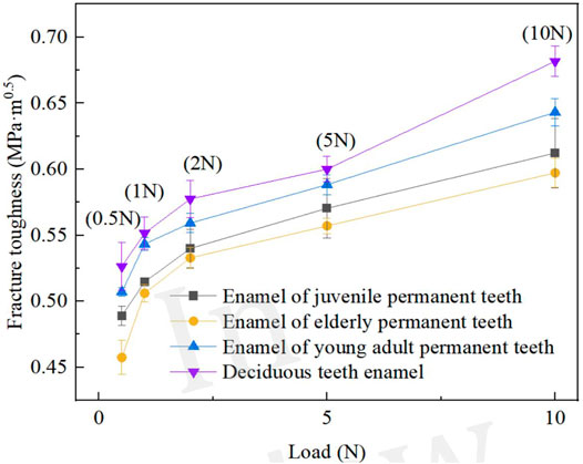 The influence of age and orthodontic debonding on the prevalence and  severity of enamel craze lines - ScienceDirect