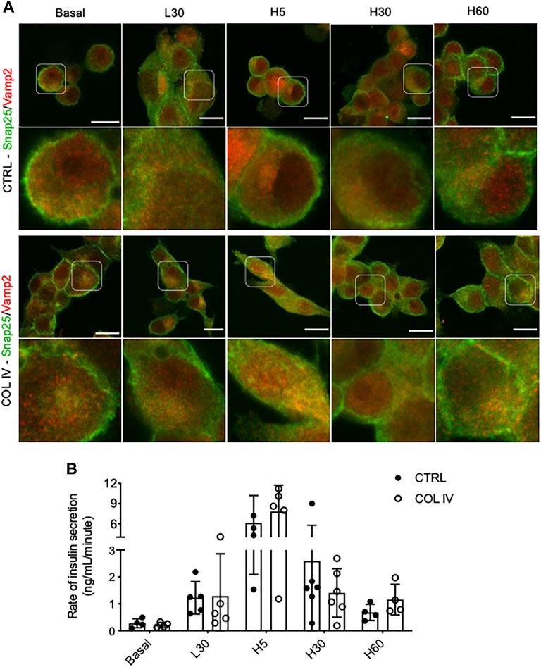 Frontiers  Collagen IV-β1-Integrin Influences INS-1 Cell Insulin