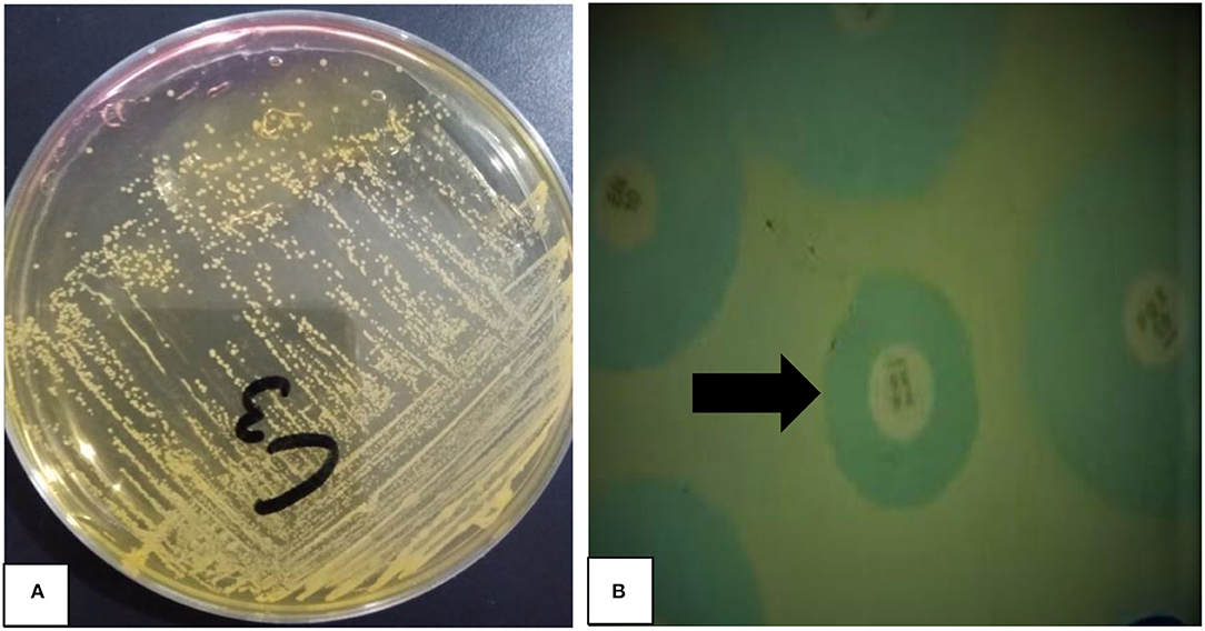 Staphylococcus Aureus - Stepwards