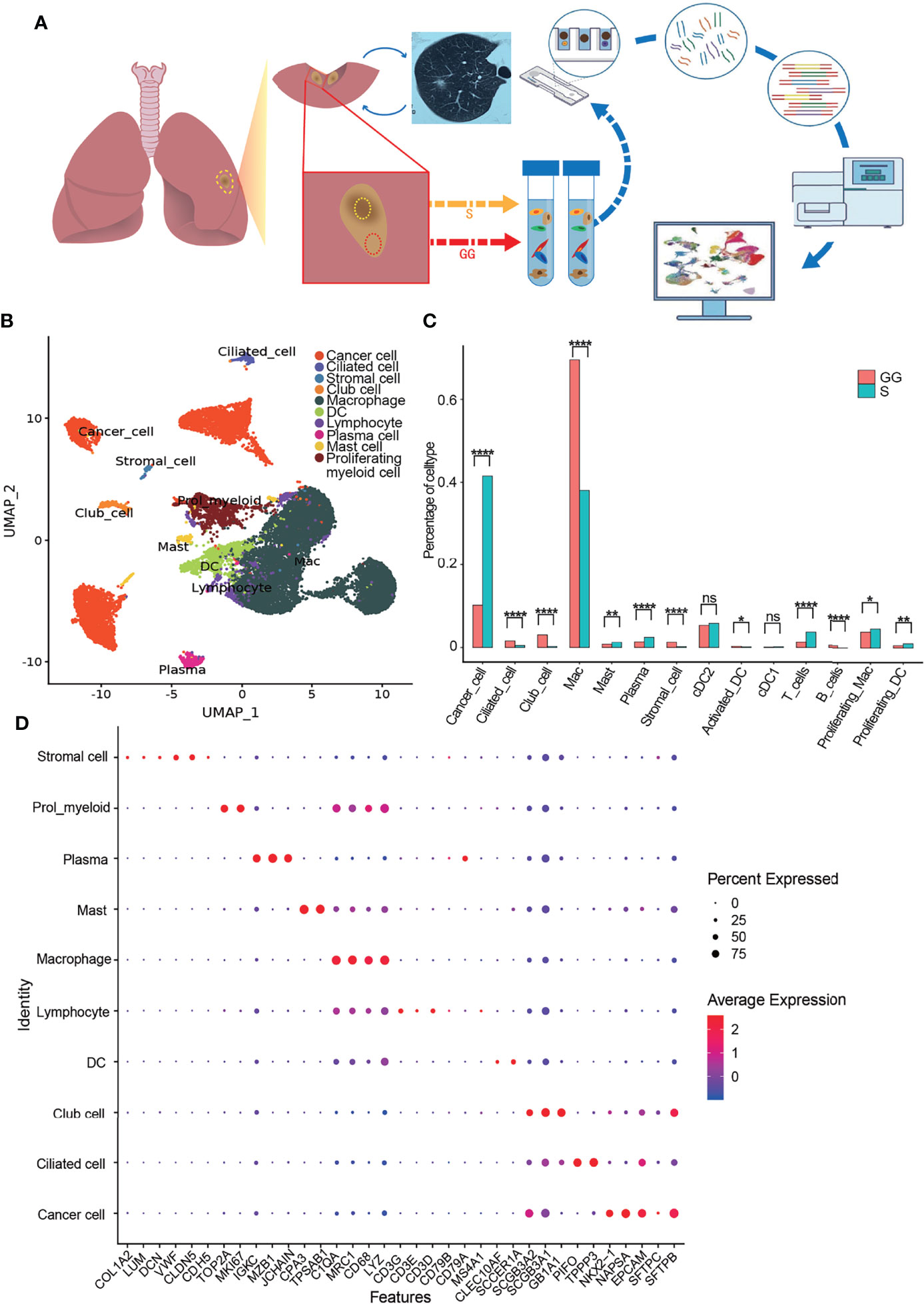 Frontiers  Single-Cell RNA Sequencing Unravels Distinct Tumor  Microenvironment of Different Components of Lung Adenocarcinoma Featured as  Mixed Ground-Glass Opacity