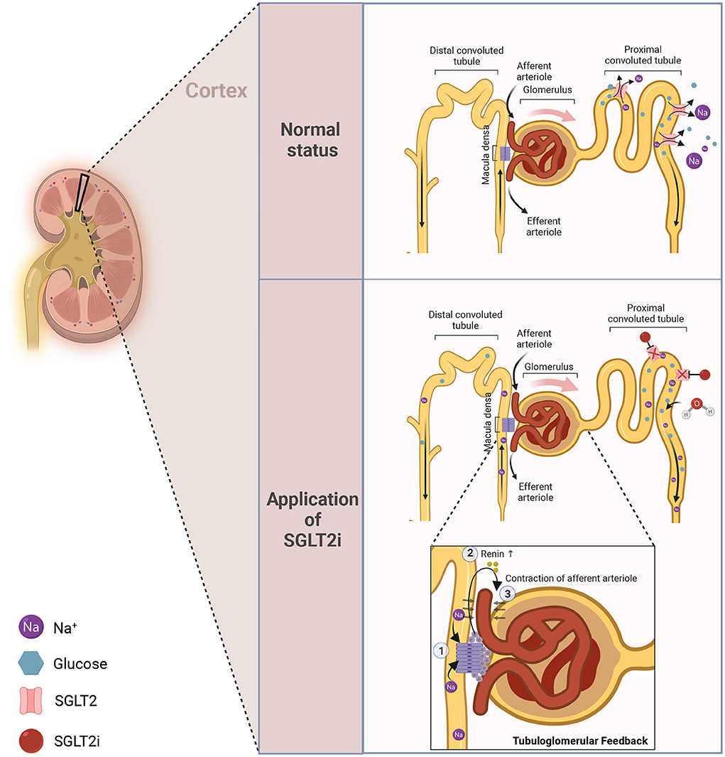 Frontiers New Insights And Advances Of Sodium glucose Cotransporter 2 