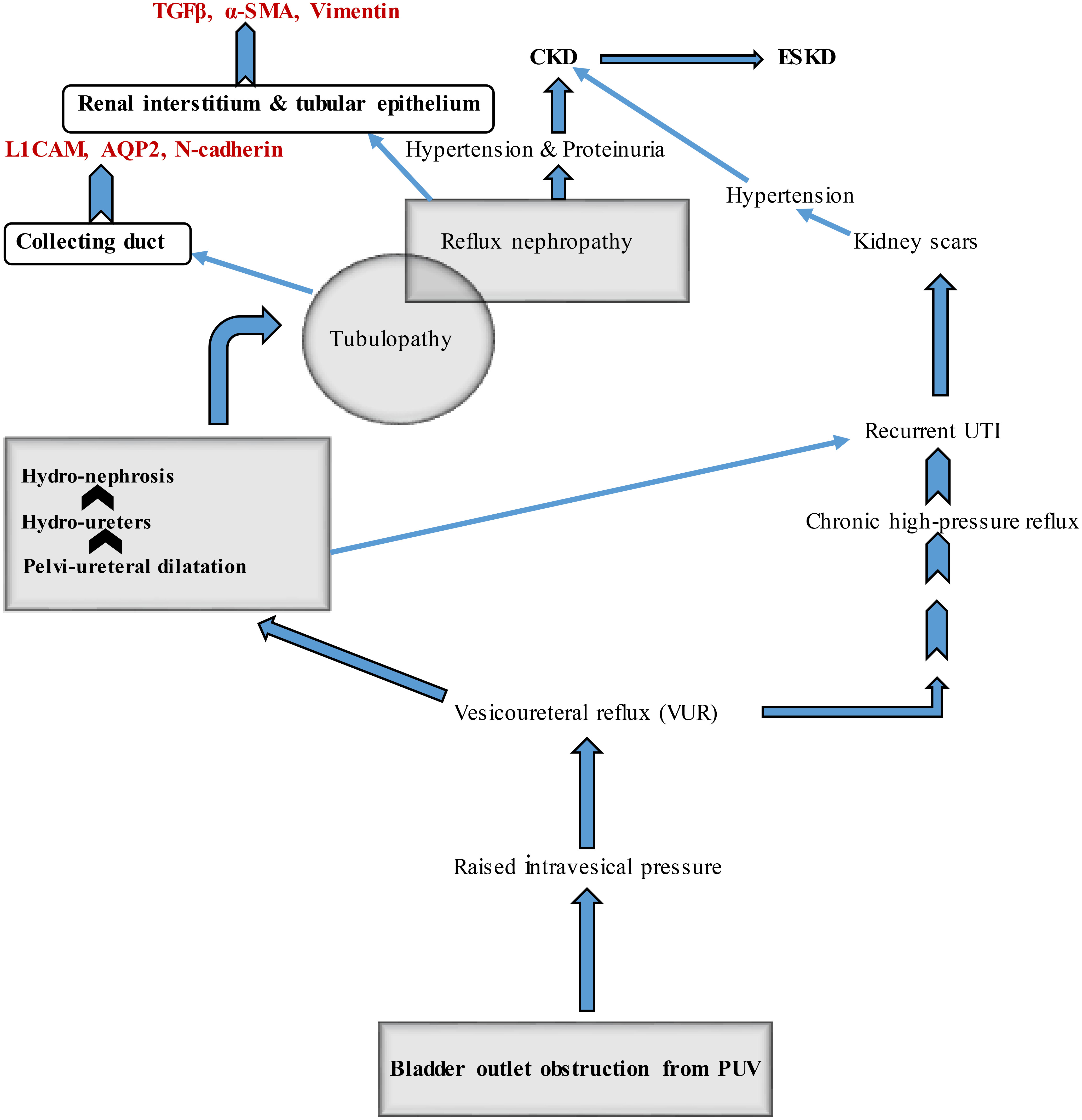 Frontiers Posterior Urethral Valve In Children Using Novel 