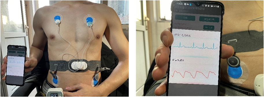 Frontiers | Wearable Electrocardiogram Quality Assessment Using 