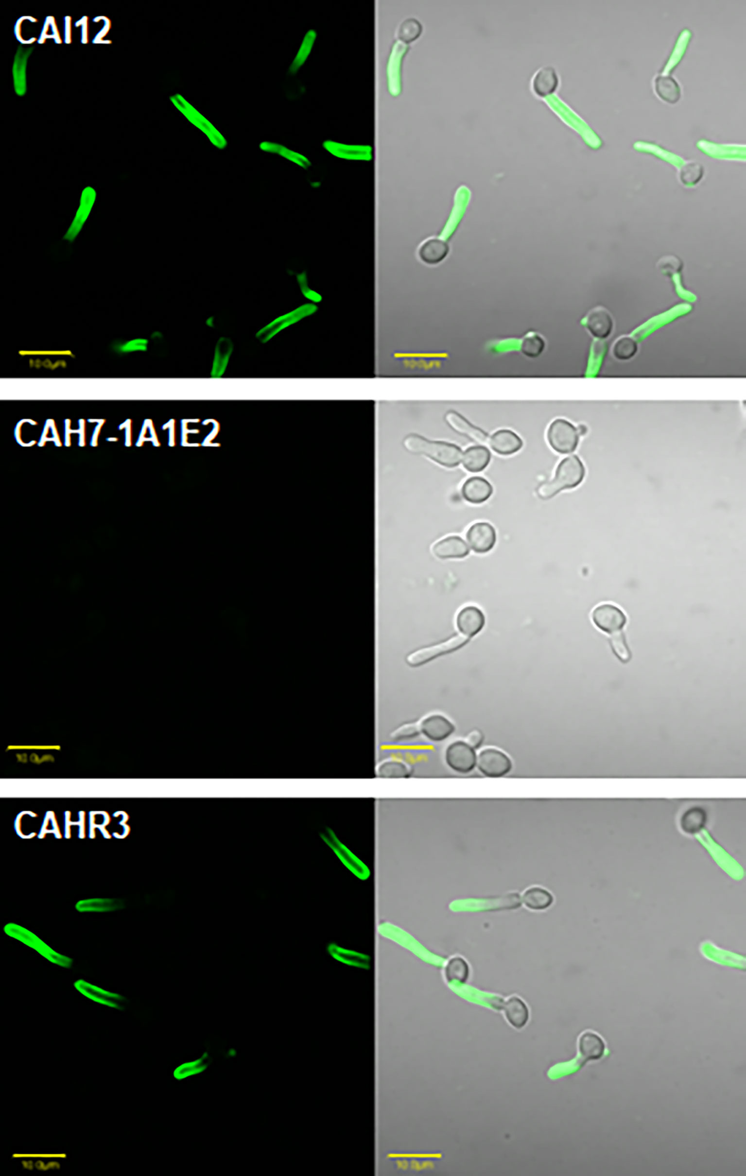 Frontiers Development And Use Of A Monoclonal Antibody Specific For The Candida Albicans Cell 