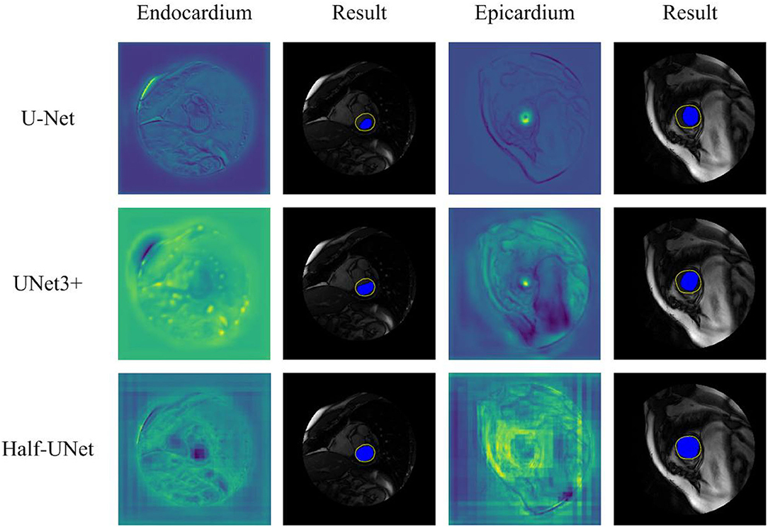 Frontiers  Half-UNet: A Simplified U-Net Architecture for Medical Image  Segmentation