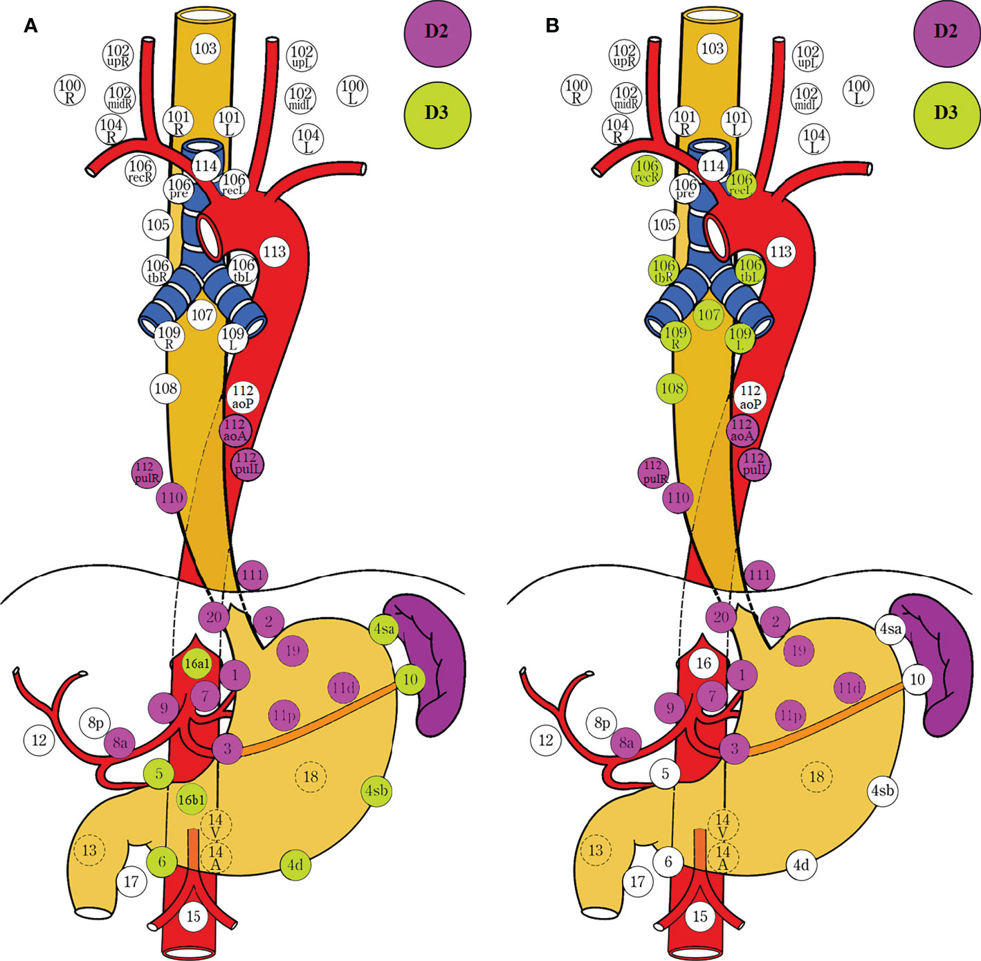 Frontiers Mapping Of Lymph Node Dissection Determined By The 