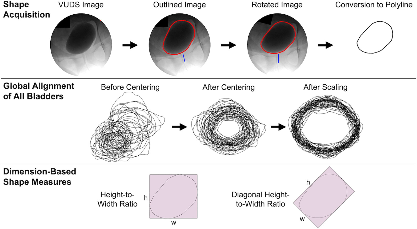 Frontiers  Use of statistical shape modeling to enhance the fluoroscopic  evaluation of the bladder