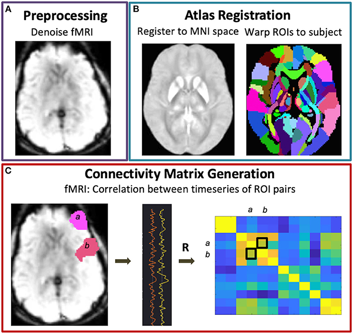 Frontiers | Functional Network Alterations In Young Brain Tumor ...