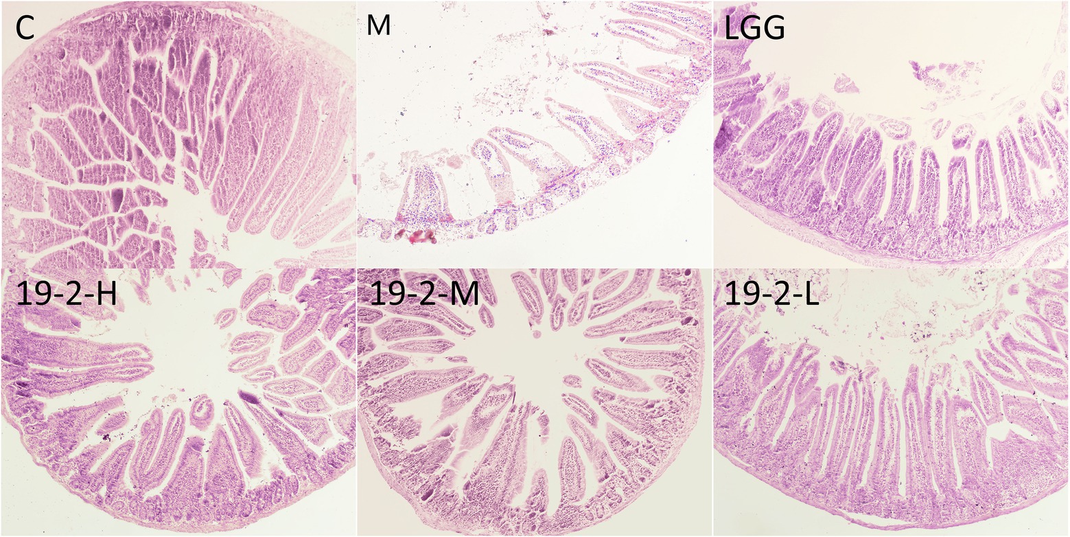 Frontiers | Effects of Lactiplantibacillus plantarum 19-2 on 