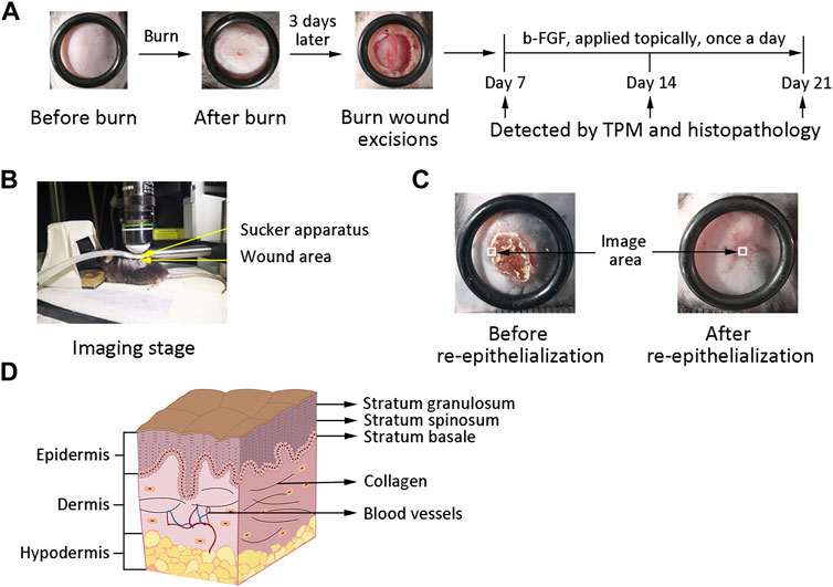 Early visualization of skin burn severity using a topically