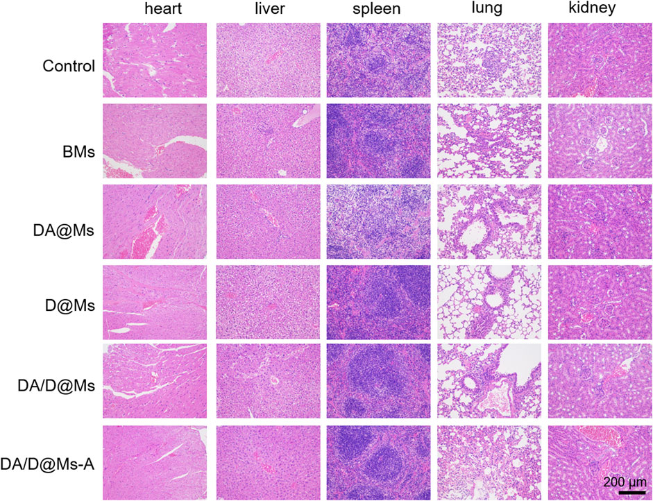 Frontiers | Tumor Cell-Specific and Lipase-Responsive Delivery of ...
