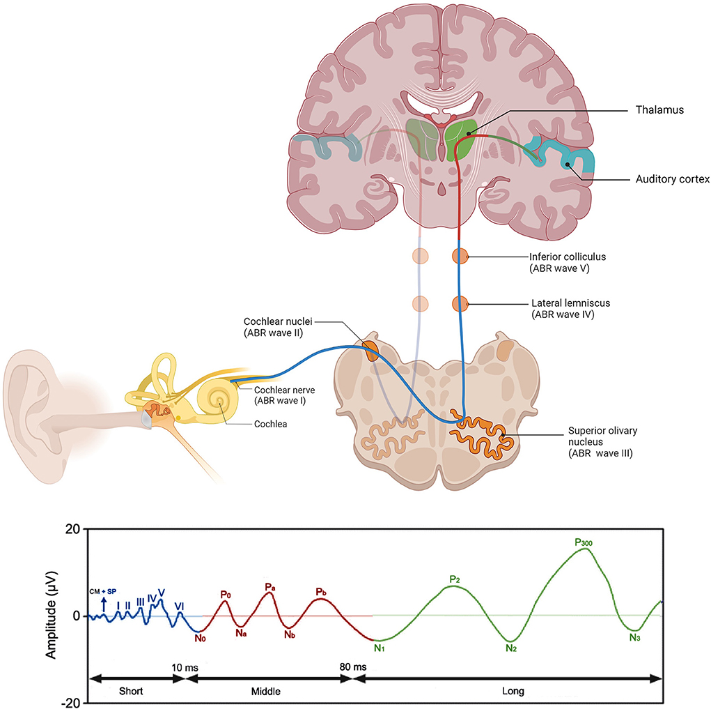 PDF] Assessment of Hearing Impairment Using Brainstem Evoked Response  Audiometry ( BERA ) In Neonates with Various Otonoxious Risk Factors