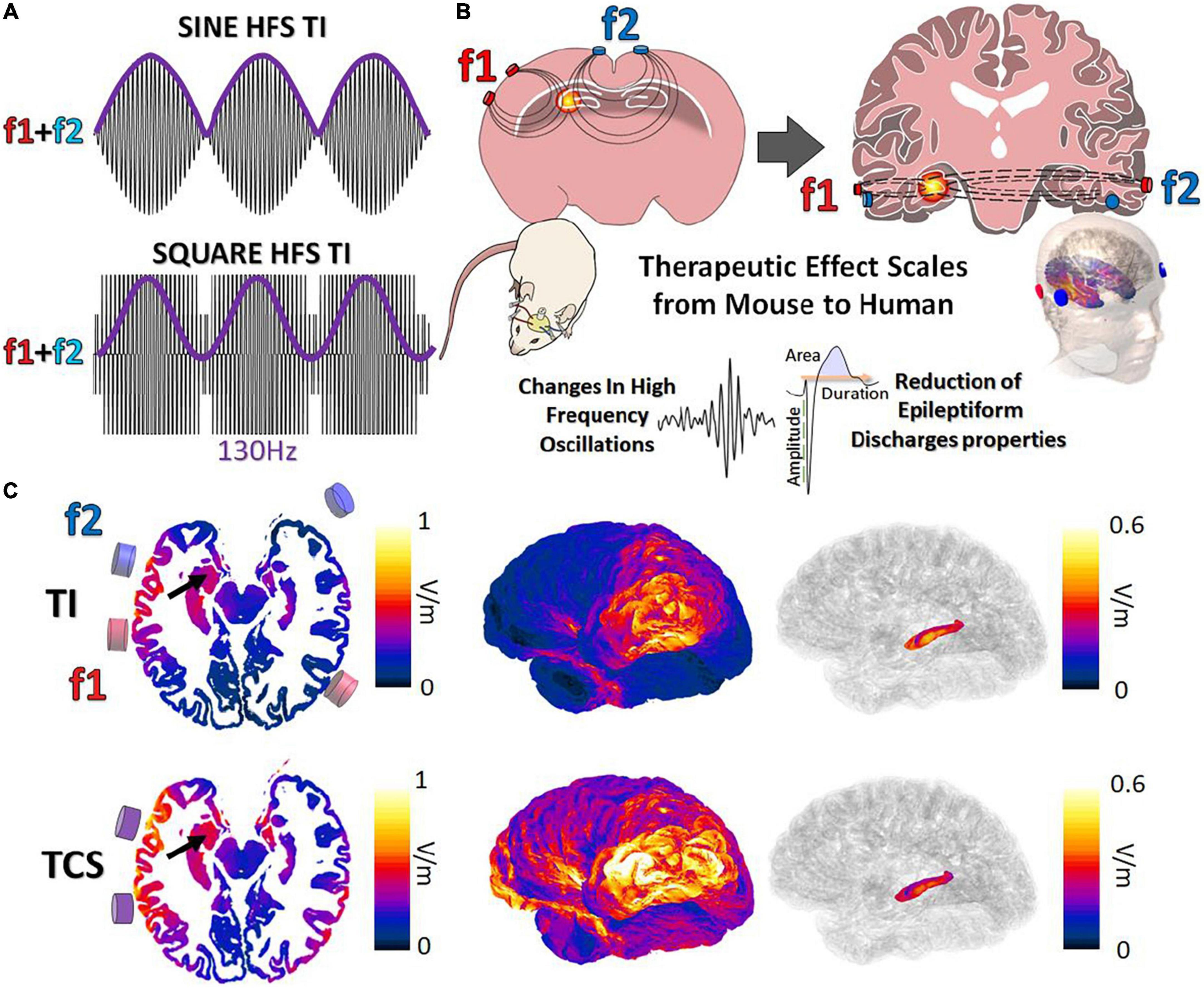 Frontiers | Focal non-invasive deep-brain stimulation with temporal ...