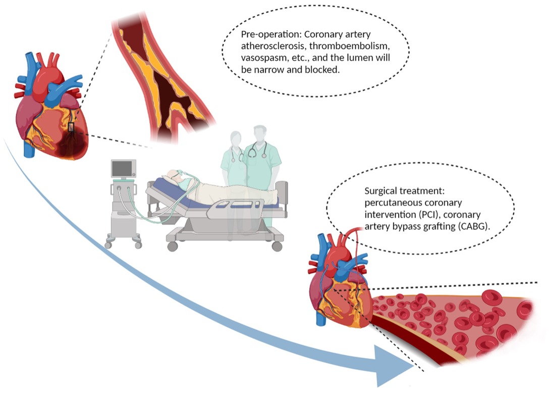 coronary heart disease case study examples