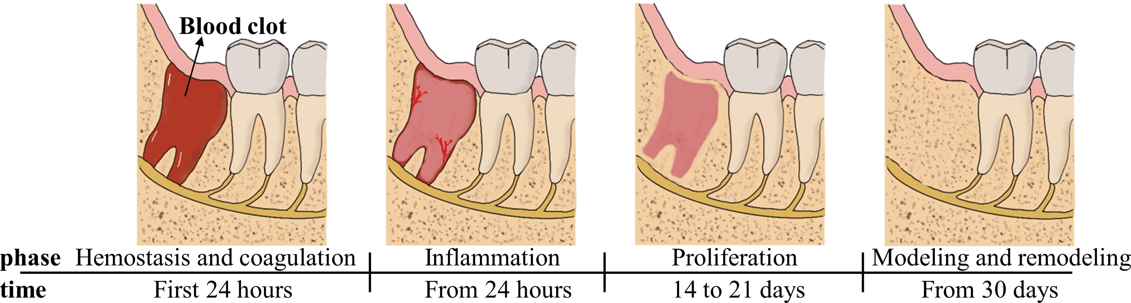 normal healing after tooth extraction