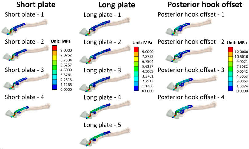 Frontiers  Biomechanical effects of different numbers and locations of  screw-in clavicle hook plates