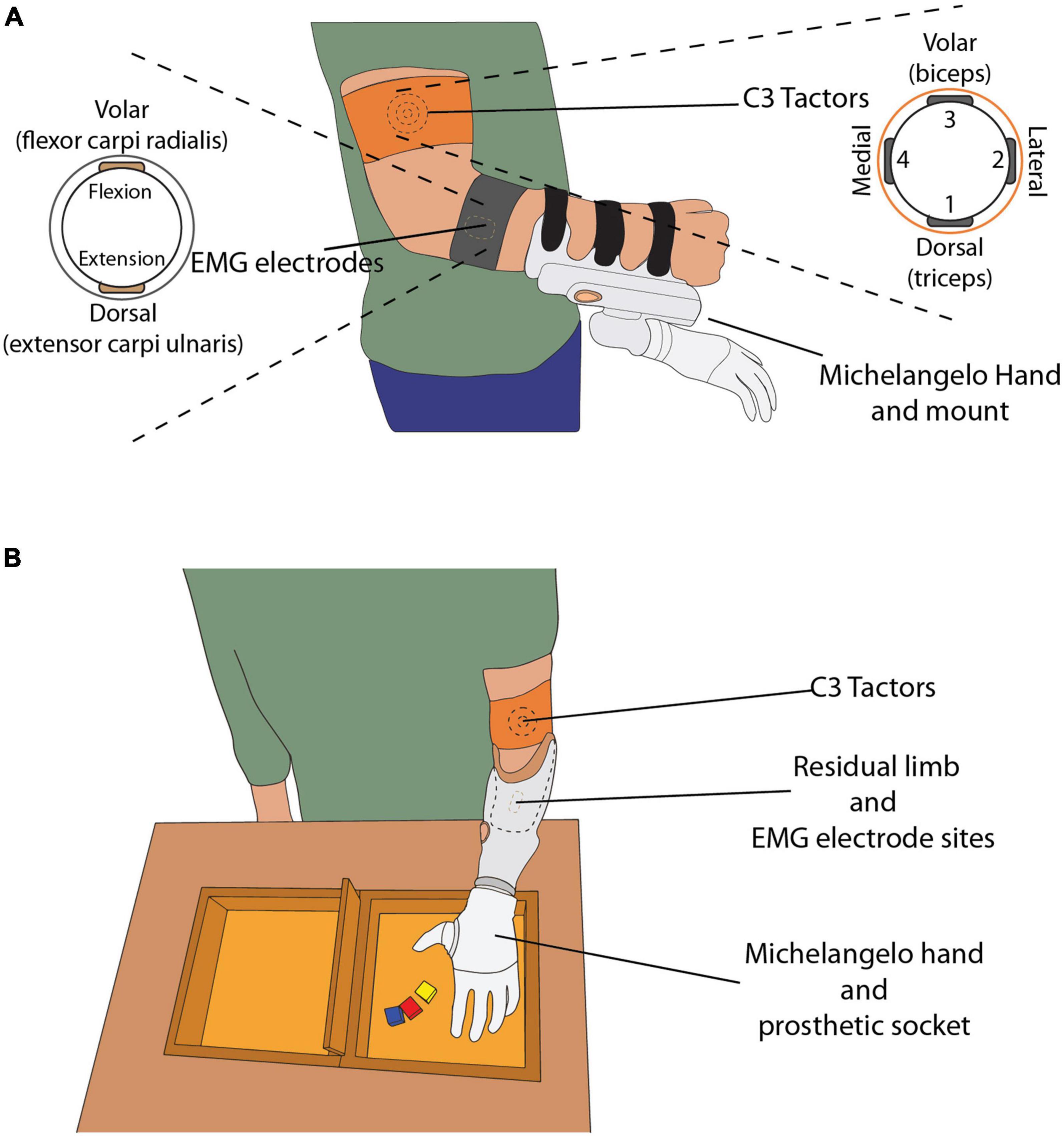 Frontiers  EMG feedback outperforms force feedback in the presence of  prosthesis control disturbance