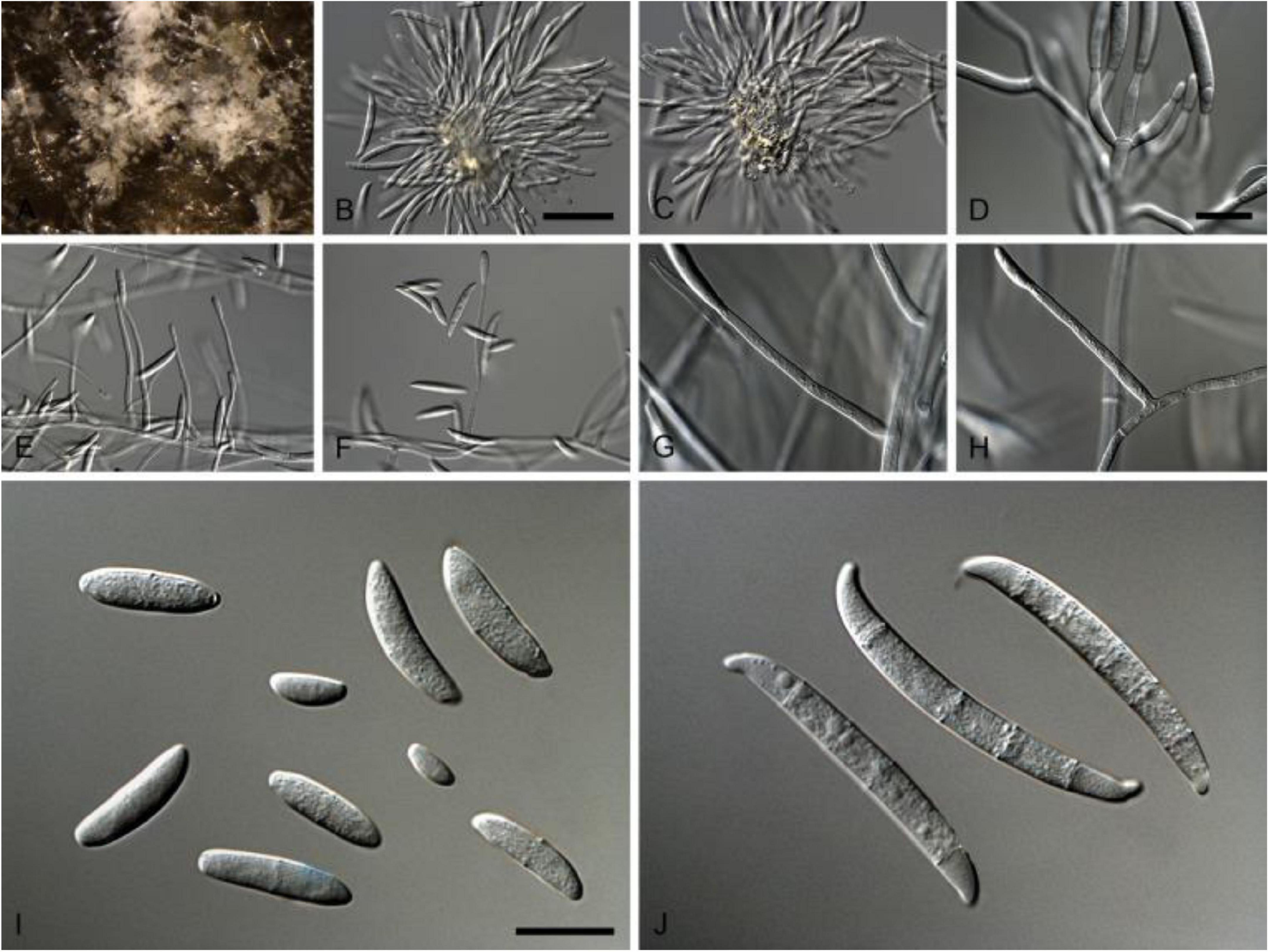 Frontiers  Characterization of fungal pathogens and germplasm