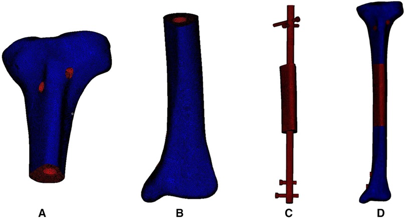 Frontiers | Influence Of Different Fixation Modes On Biomechanical ...