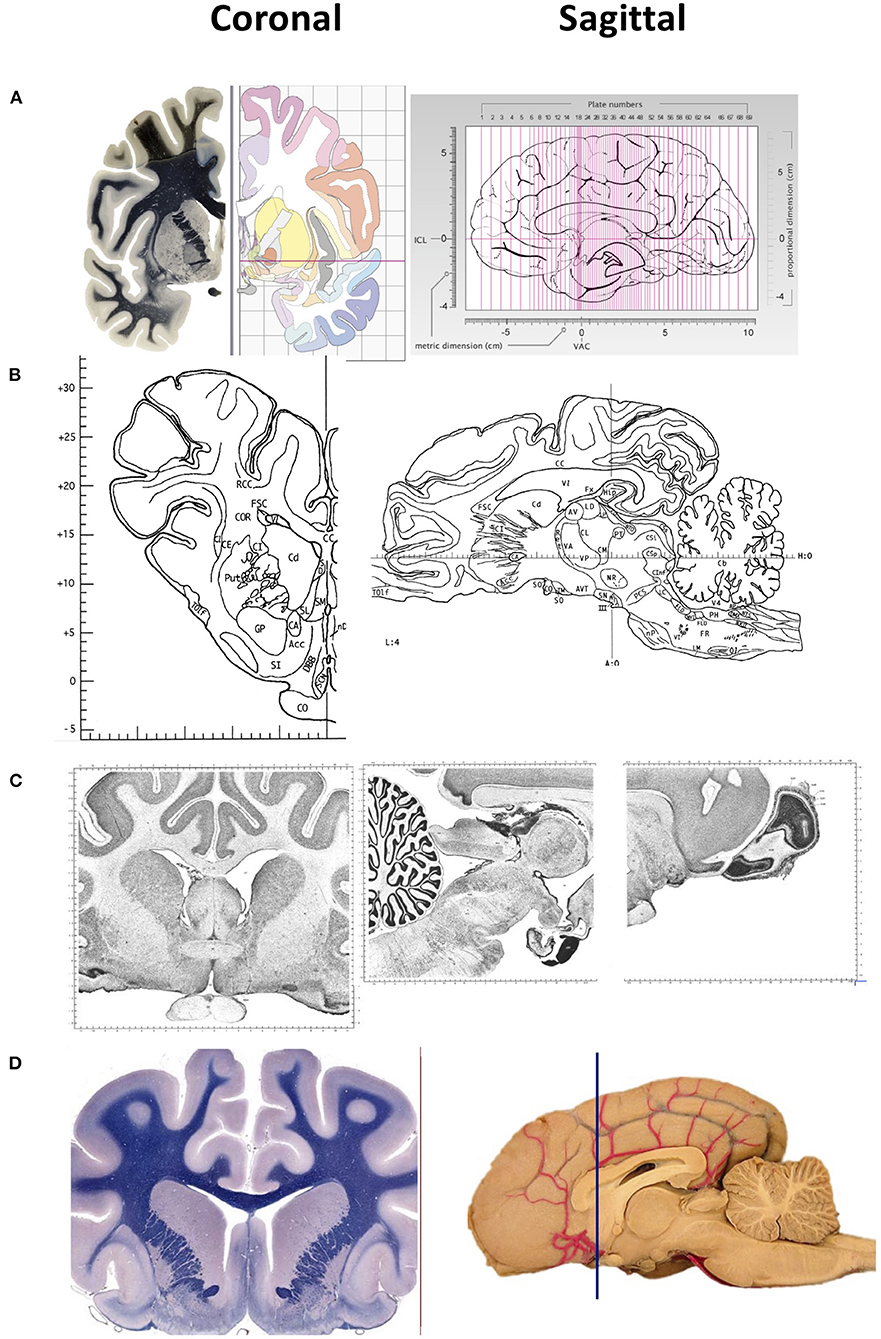 New brain atlas offers comprehensive map of the human brain